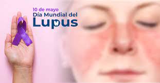 9 de Mayo: Dia mundial del Lupus