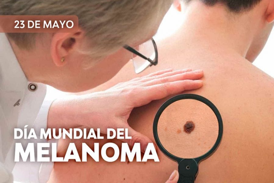23 de Mayo: Día Mundial contra el Melanoma
